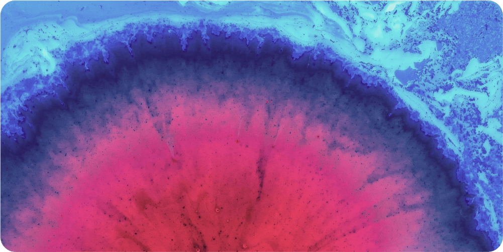 Страх рецидива. Как справляться